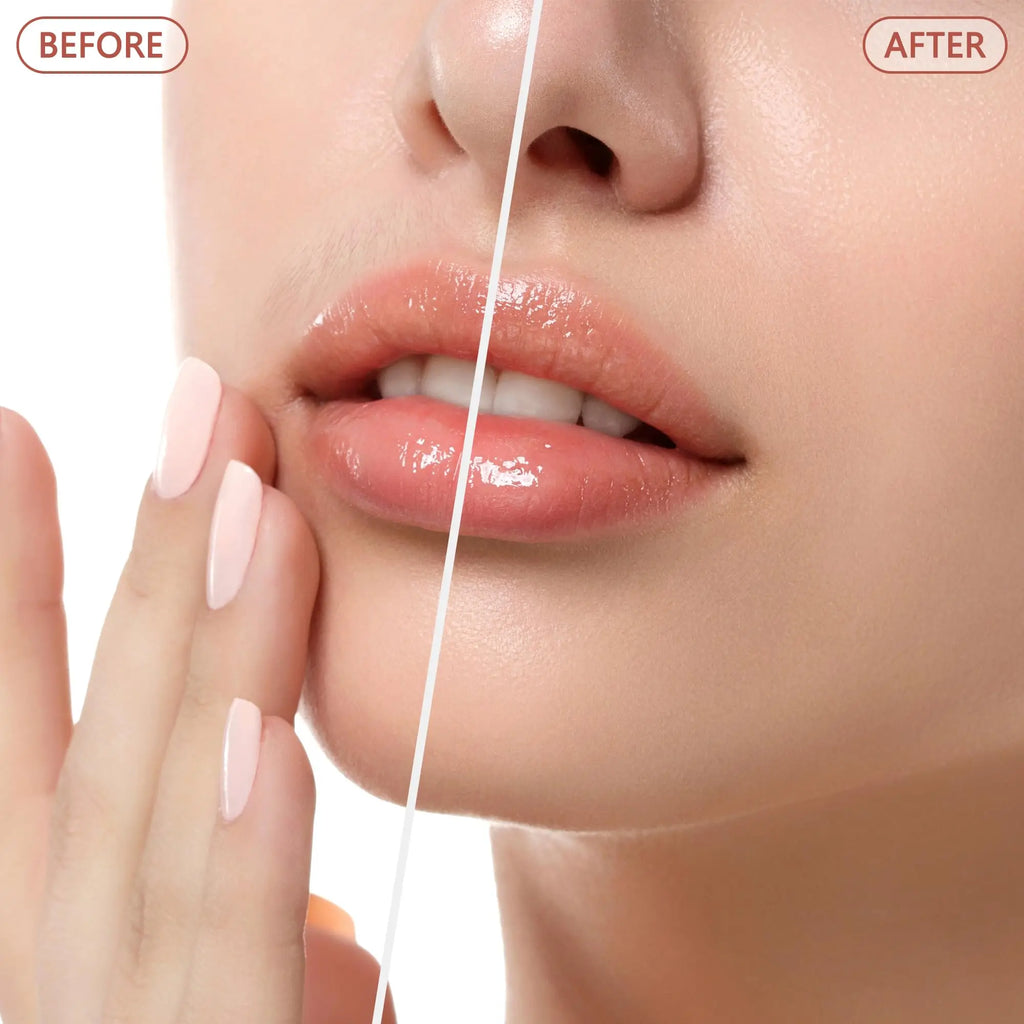 Depilador Facial Feminino